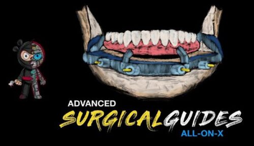 implant ninja advanced surgical guides all on
