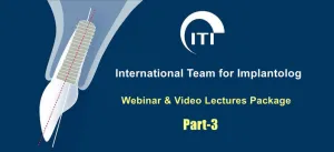 iti international team for implantology webinar video part 3
