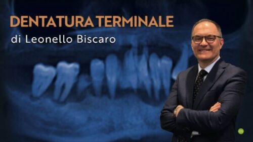 osteocom dentatura terminale 600x338 1