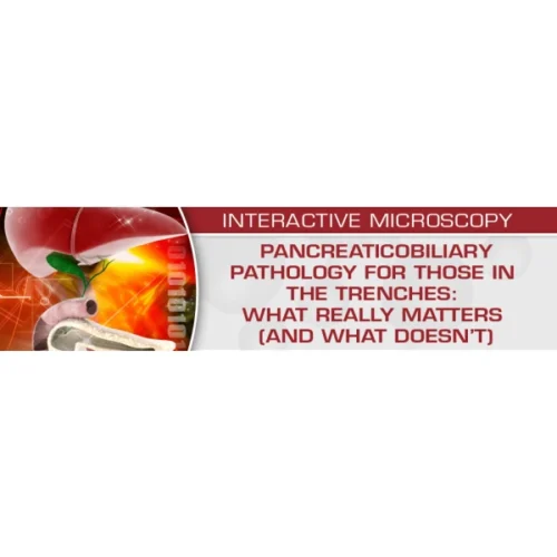 pancreaticobiliary pathology for those in the trenches what really matters and what doesnt 600x600 png