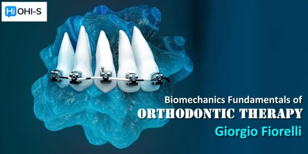 OHI-S Biomechanics Fundamentals of Orthodontic Therapy – Giorgio ...