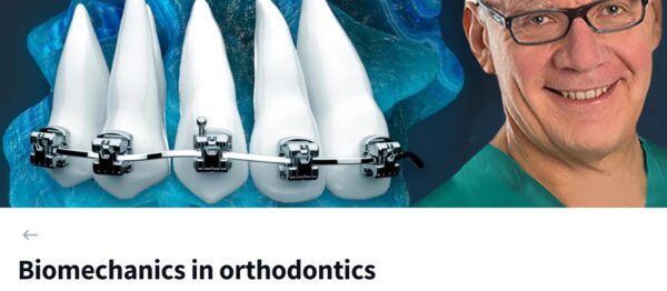 OHI-S Biomechanics in Orthodontics – Giorgio Fiorelli - Ophthalmology ...