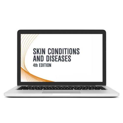 skin conditions