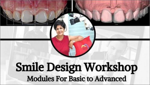 smile design workshop modules for basic to advanced shail jaggi