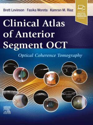 Clinical Atlas of Anterior Segment OCT Optical Coherence Tomography