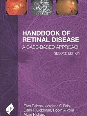 Handbook of Retinal Disease A Cased Based Approach 2nd Edition