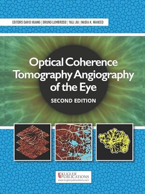 Optical Coherence Tomography Angiography of the Eye 2nd Edition