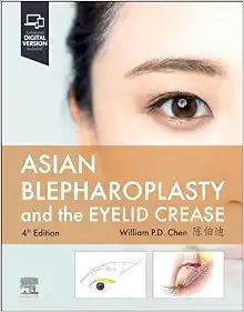 Asian Blepharoplasty And The Eyelid Crease 4th Edition