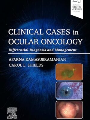 Clinical Cases in Ocular Oncology Clinical Cases in Ocular Oncology