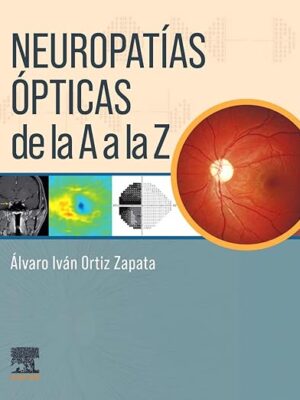 Neuropatias opticas de la A a la Z