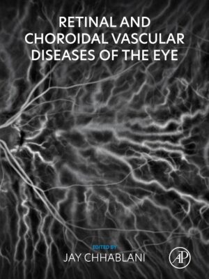 Retinal and Choroidal Vascular Diseases of the Eye