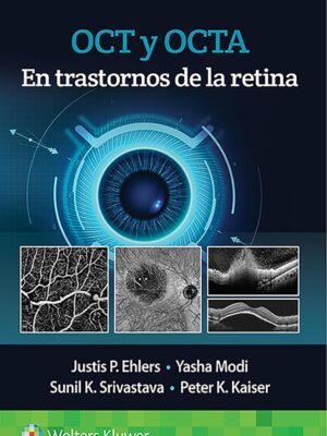 OCT y OCTA en trastornos de la retina Spanish Edition Original PDF from Publisher