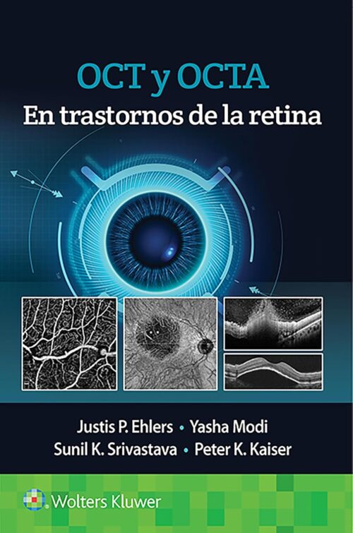 OCT y OCTA en trastornos de la retina (Spanish Edition) (Original PDF from Publisher)