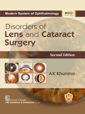 Disorders of Lens and Cataract Surgery, 2nd edition (Original PDF from Publisher)