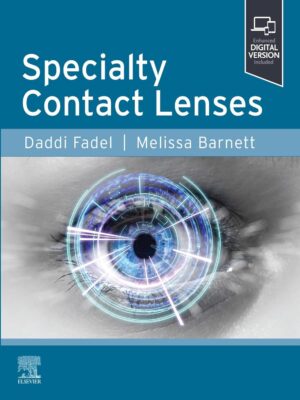 Specialty Contact Lenses (Original PDF from Publisher)