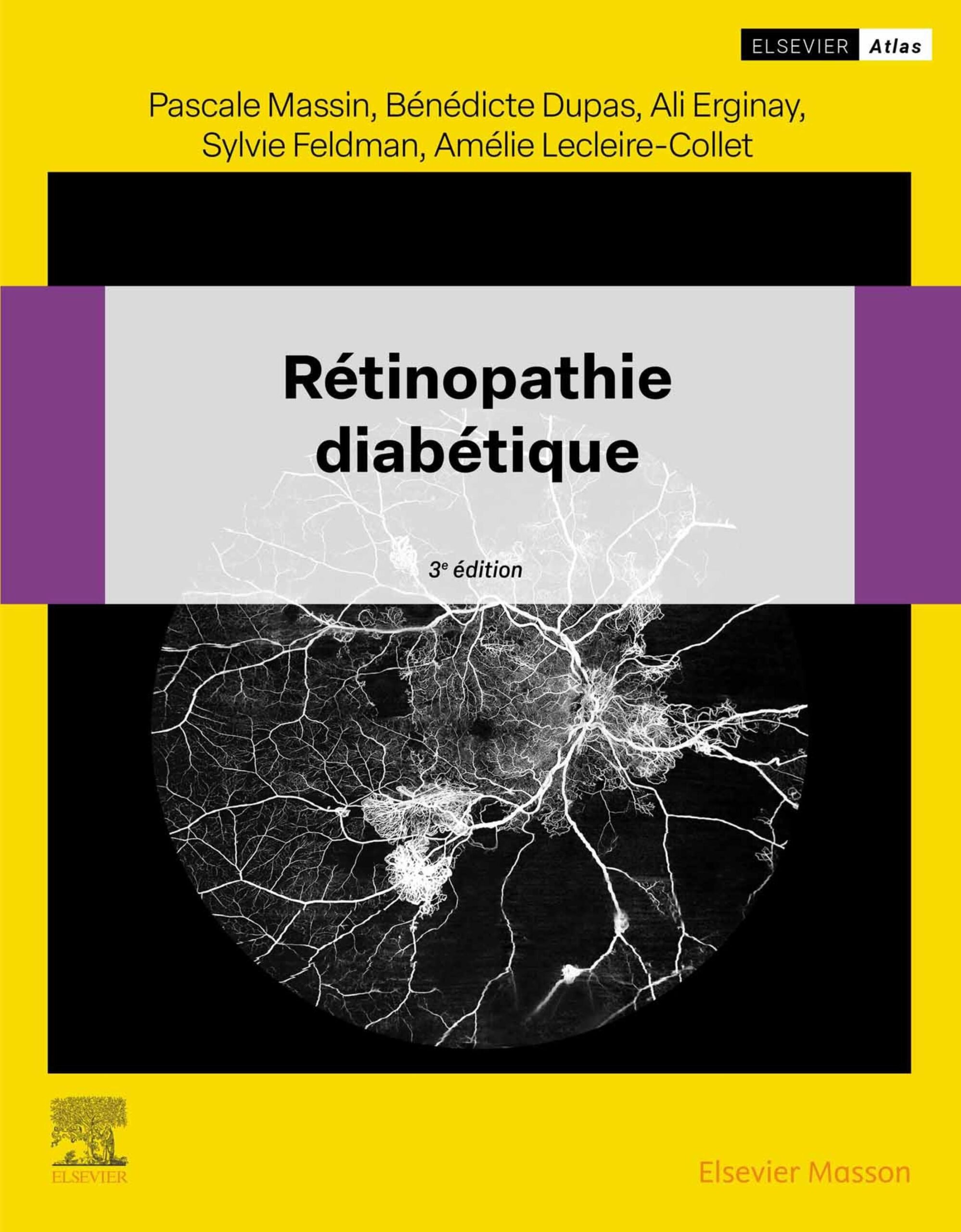 Rétinopathie diabétique, 3rd Edition (EPUB) 1 Rétinopathie diabétique, 3rd Edition (EPUB)
