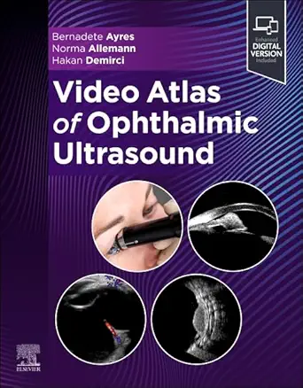Video Atlas of Ophthalmic Ultrasound (EPUB) 1 Video Atlas of Ophthalmic Ultrasound (EPUB)